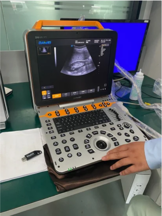 Cost-Effective Portable Color Ultrasound-SD-P60