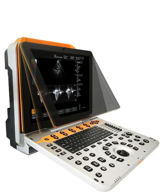 Cost-Effective Portable Color Ultrasound-SD-P60