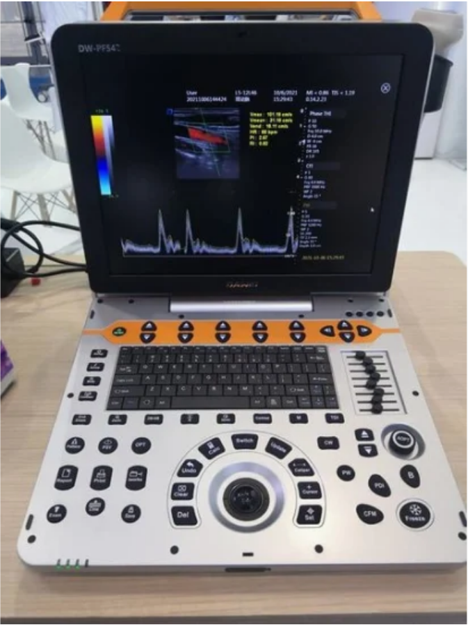 Cost-Effective Portable Color Ultrasound-SD-P60
