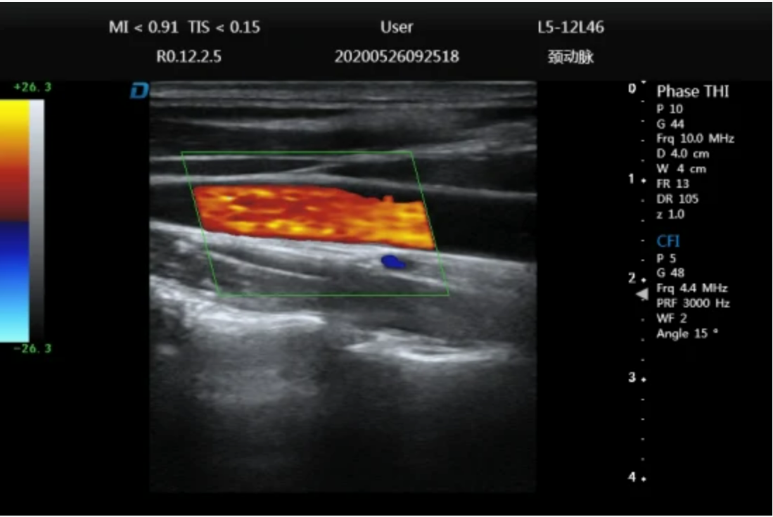 Cost-Effective Portable Color Ultrasound-SD-P60