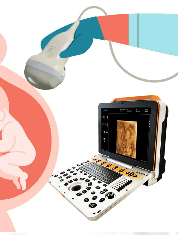 Cost-Effective Portable Color Ultrasound-SD-P60